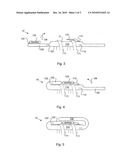 Carrying strap diagram and image