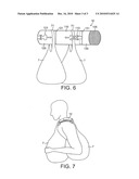 Carrying strap diagram and image