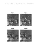 MEDICAL IMAGING METHOD IN WHICH VIEWS CORRESPONDING TO 3D IMAGES ARE SUPERIMPOSED OVER 2D IMAGES diagram and image