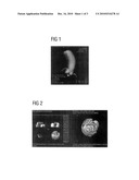 HIGH-RESOLUTION THREE-DIMENSIONAL MEDICAL IMAGING WITH DYNAMIC REAL-TIME INFORMATION diagram and image