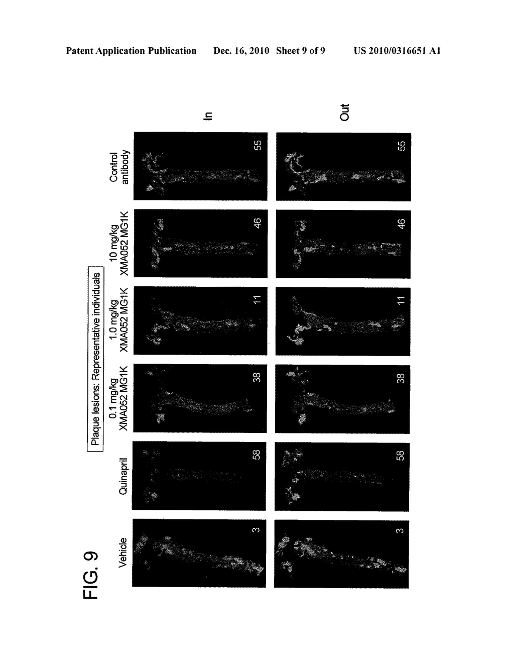 CARDIOVASCULAR RELATED USES OF IL-1BETA ANTIBODIES AND BINDING FRAGMENTS THEREOF - diagram, schematic, and image 10