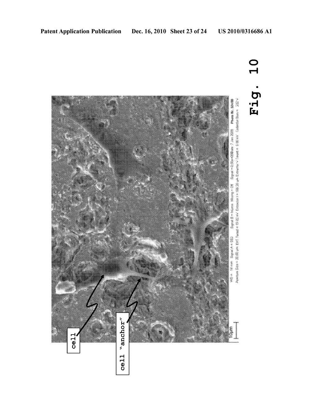 Osteosynthesis with nano-silver - diagram, schematic, and image 24