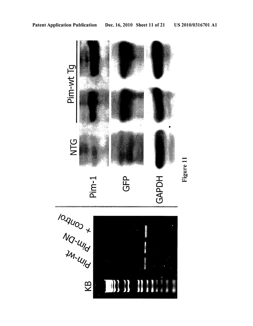 COMPOSITIONS AND METHOD FOR MANIPULATING PIM-1 ACTIVITY IN CIRCULATORY SYSTEM CELLS - diagram, schematic, and image 12