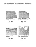 COMPOSITIONS AND METHODS FOR TREATING INFLAMMATION diagram and image