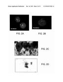 METHODS AND KITS FOR DIAGNOSING LUNG CANCER diagram and image