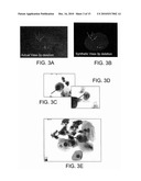 METHODS AND KITS FOR DIAGNOSING LUNG CANCER diagram and image