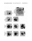 METHODS AND KITS FOR DIAGNOSING LUNG CANCER diagram and image