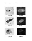 METHODS AND KITS FOR DIAGNOSING LUNG CANCER diagram and image