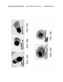 METHODS AND KITS FOR DIAGNOSING LUNG CANCER diagram and image