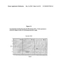 METHODS AND COMPOSITIONS FOR DIAGNOSING AND MONITORING TRANSPLANT REJECTION diagram and image