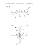 SCRATCH REMOVAL DEVICE AND METHOD diagram and image