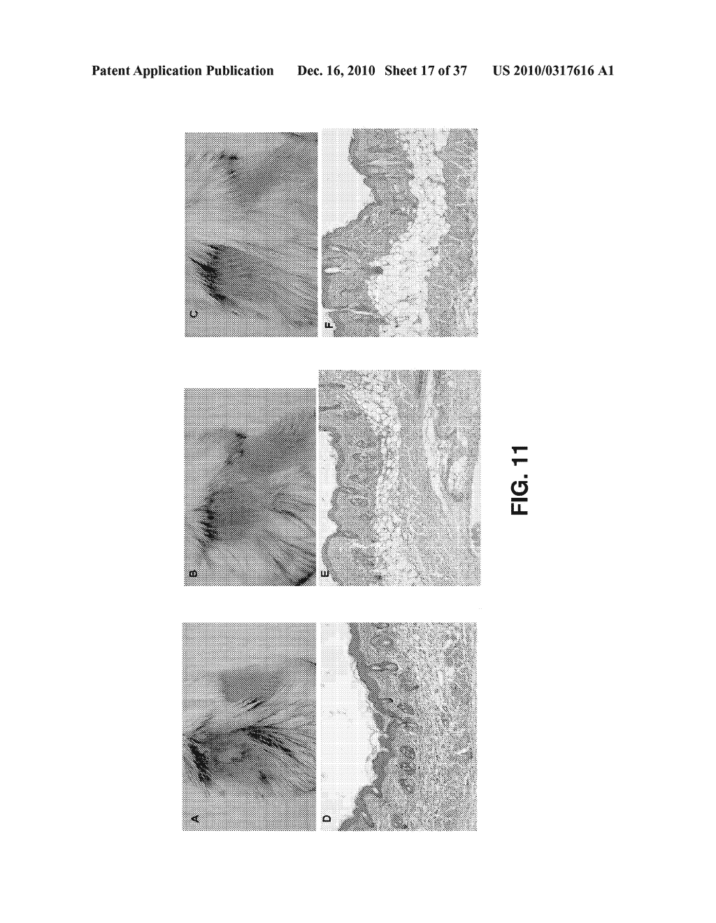ALKYLATED SEMI-SYNTHETIC GLYCOSAMINOGLYCAN ETHERS, AND METHODS OF MAKING AND USING THEREOF - diagram, schematic, and image 18