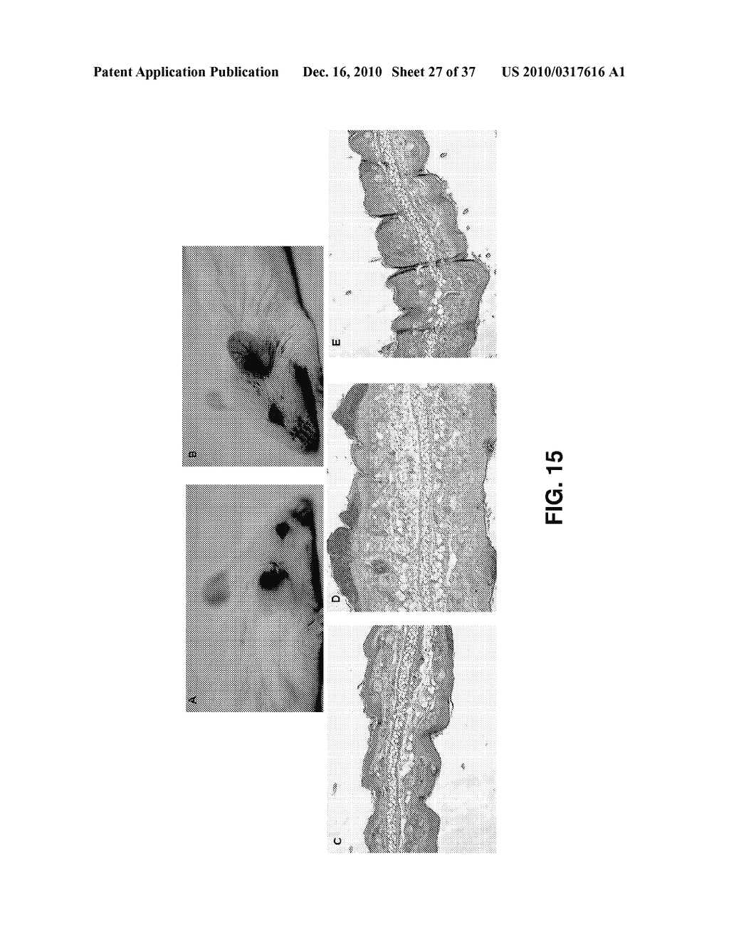 ALKYLATED SEMI-SYNTHETIC GLYCOSAMINOGLYCAN ETHERS, AND METHODS OF MAKING AND USING THEREOF - diagram, schematic, and image 28