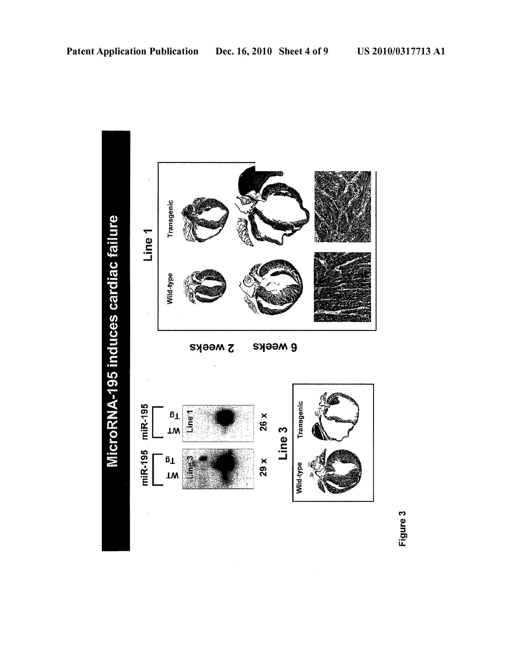 MICRO-RNAS OF THE MIR-15 FAMILY MODULATE CARDIOMYOCYTE SURVIVAL AND CARDIAC REPAIR - diagram, schematic, and image 05