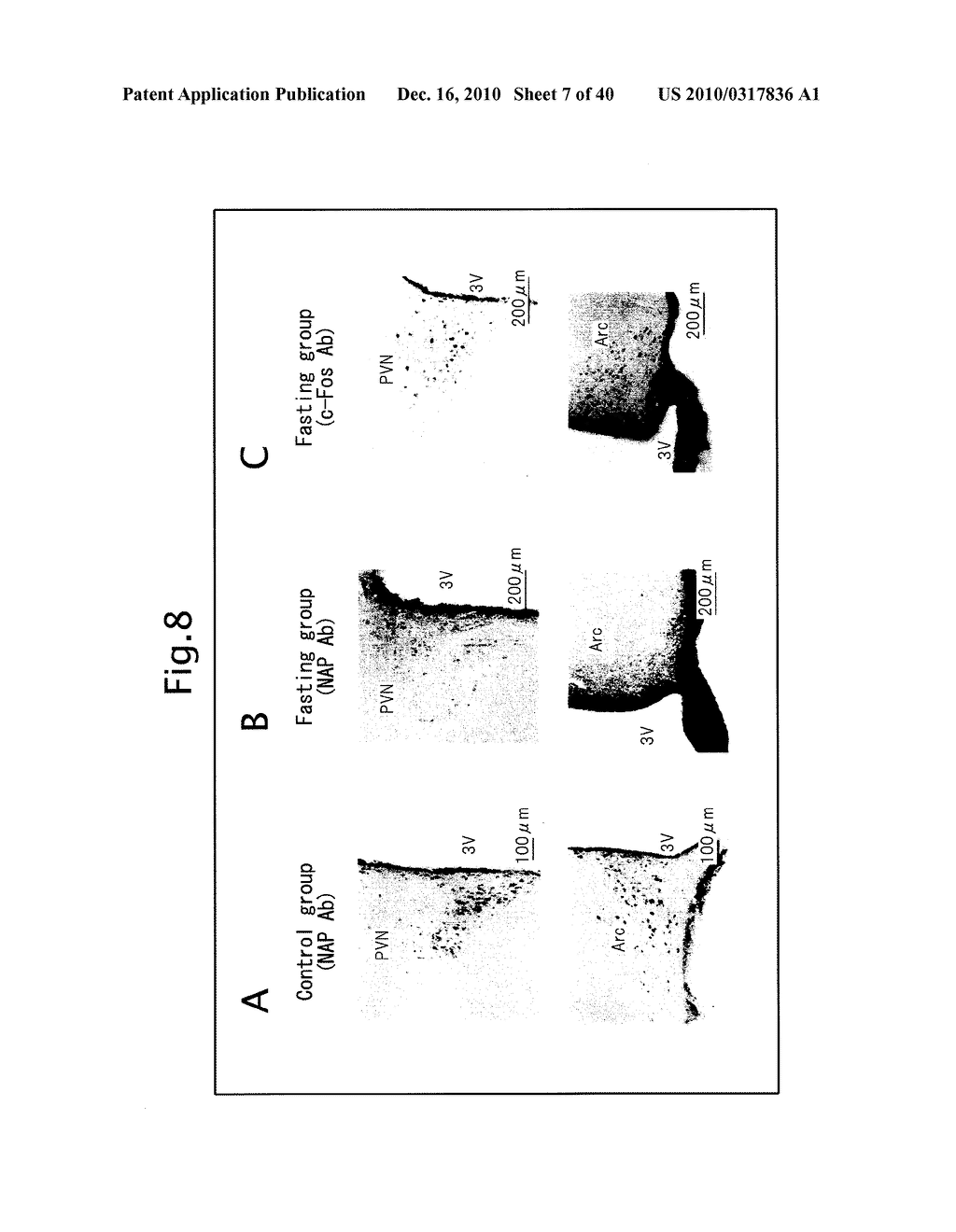 NOVEL BIOLOGICAL SUBSTANCE NESFATIN AND ITS RELATED SUBSTANCES AND USES THEREOF - diagram, schematic, and image 08