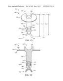 Optically Coupled Active Ossicular Replacement Prosthesis diagram and image