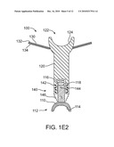 Optically Coupled Active Ossicular Replacement Prosthesis diagram and image