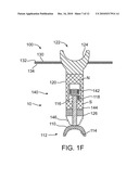 Optically Coupled Active Ossicular Replacement Prosthesis diagram and image