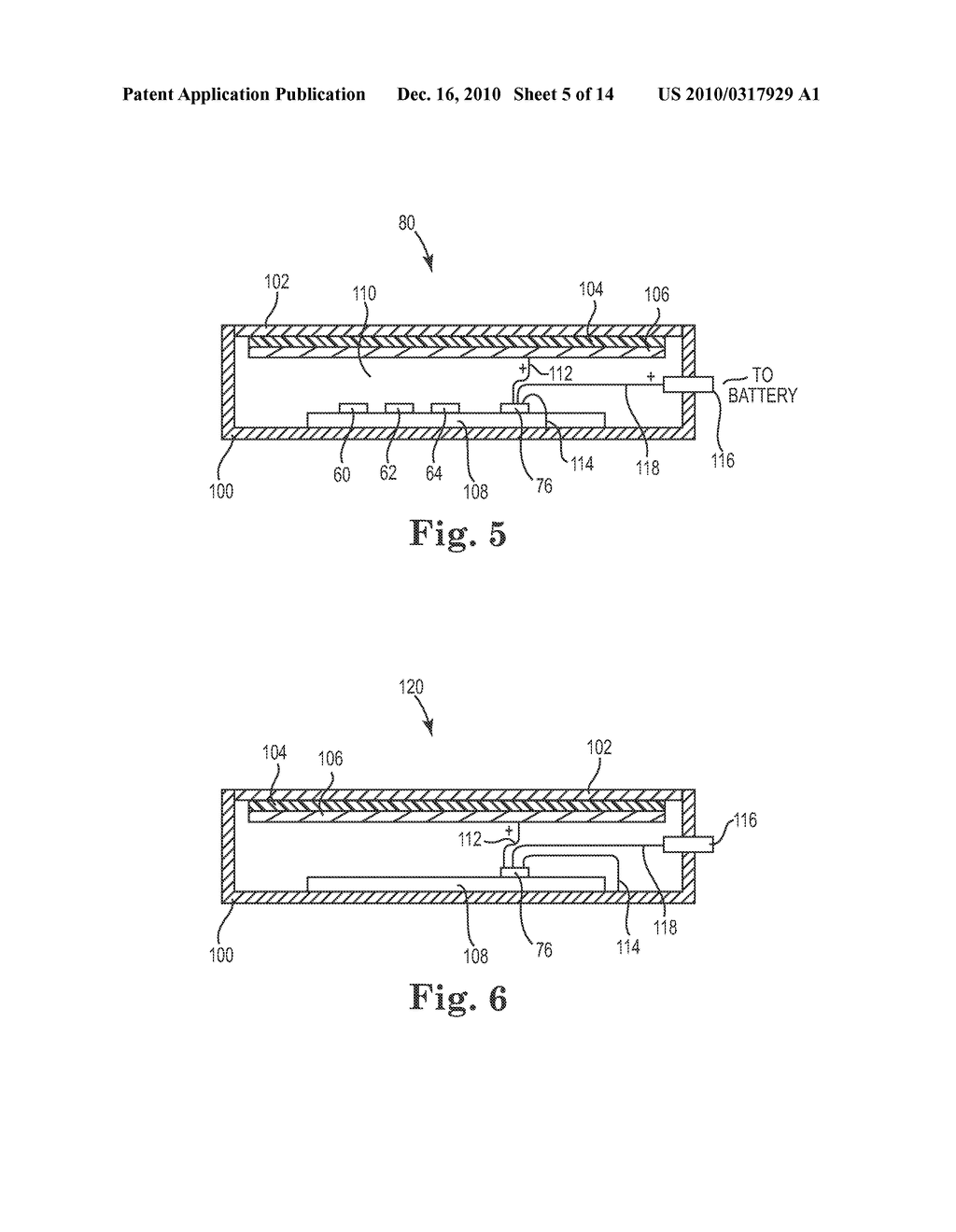 IMPLANTABLE MEDICAL DEVICES WITH PIEZOELECTRIC ANCHORING MEMBER - diagram, schematic, and image 06