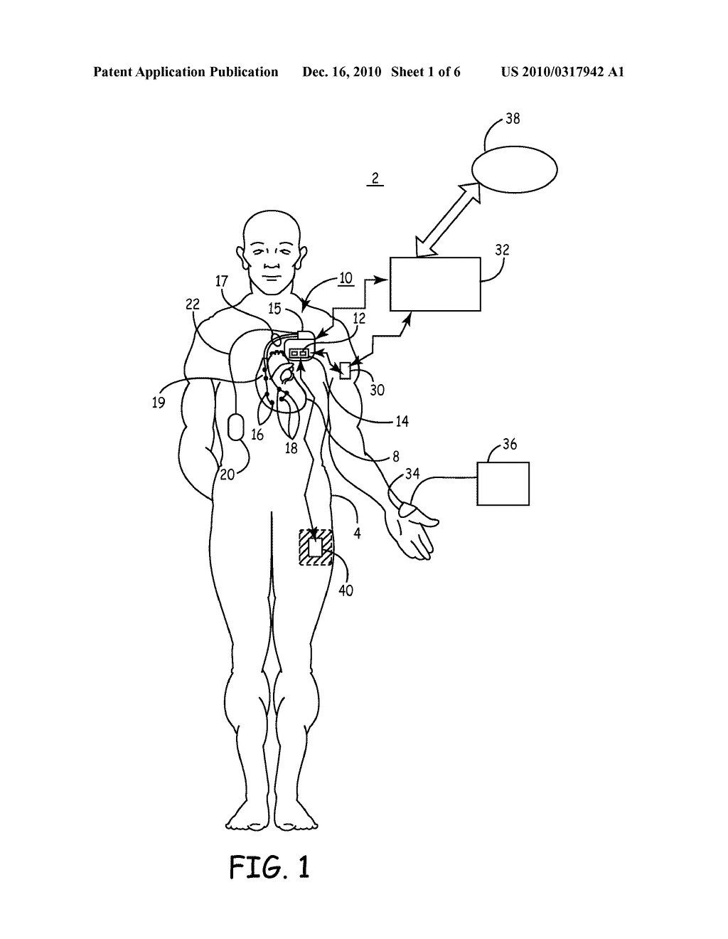 Tissue Oxygenation Monitoring in Heart Failure - diagram, schematic, and image 02