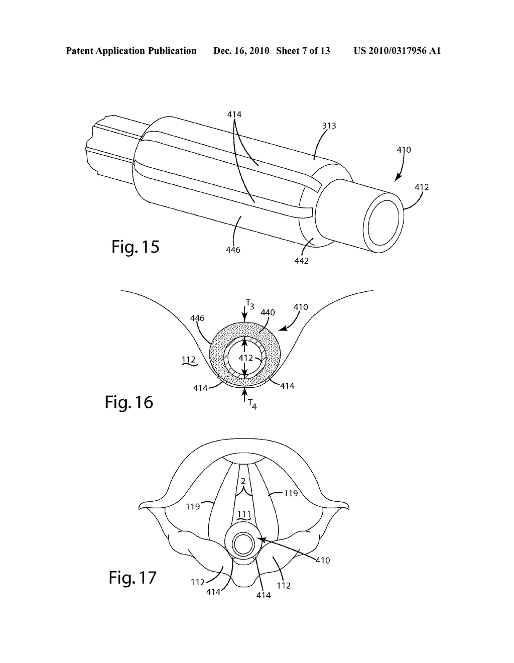 NERVE MONITORING DEVICE - diagram, schematic, and image 08