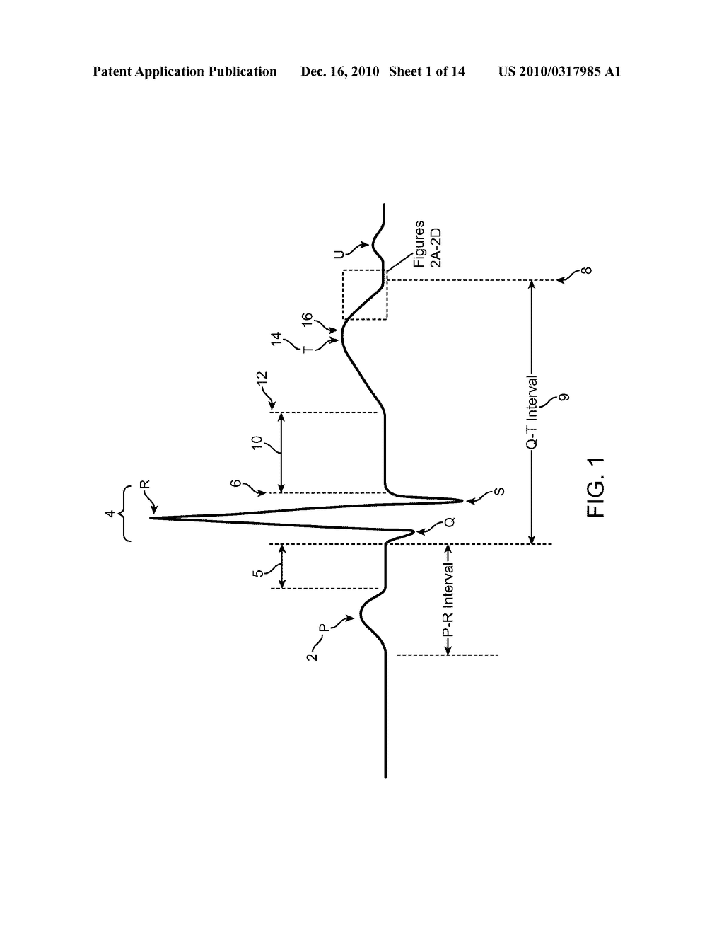 SYSTEM FOR QUANTITATIVE ASSESSMENT OF CARDIAC ELECTRICAL EVENTS - diagram, schematic, and image 02