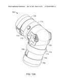 Method and Apparatus for Connective Tissue Treatment diagram and image