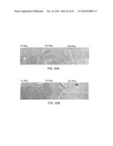 Method and Apparatus for Connective Tissue Treatment diagram and image