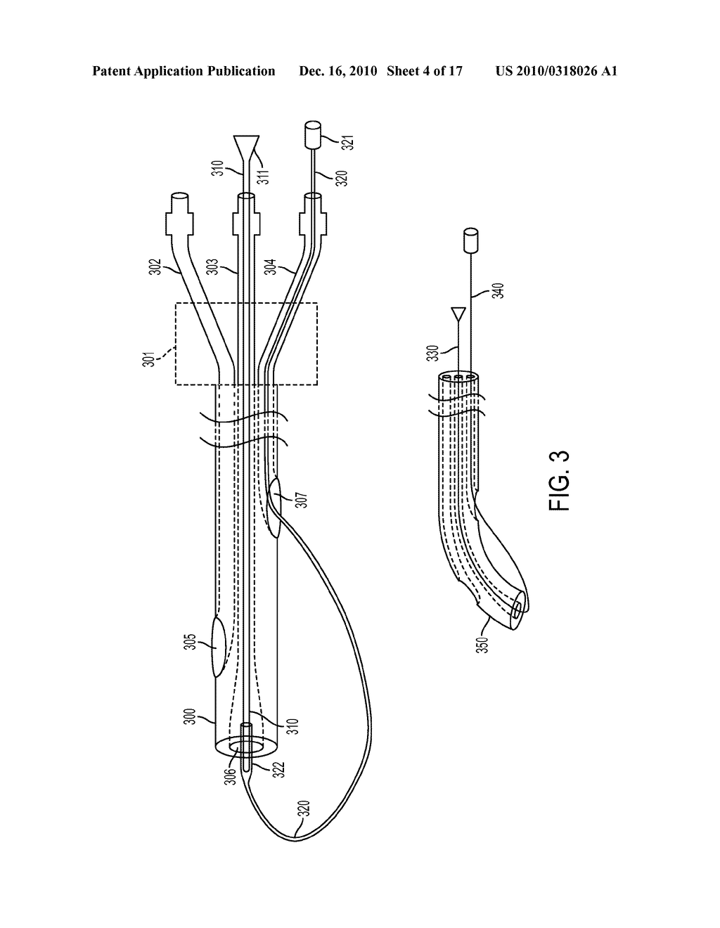 Devices and Methods for Endovascular Electrography - diagram, schematic, and image 05