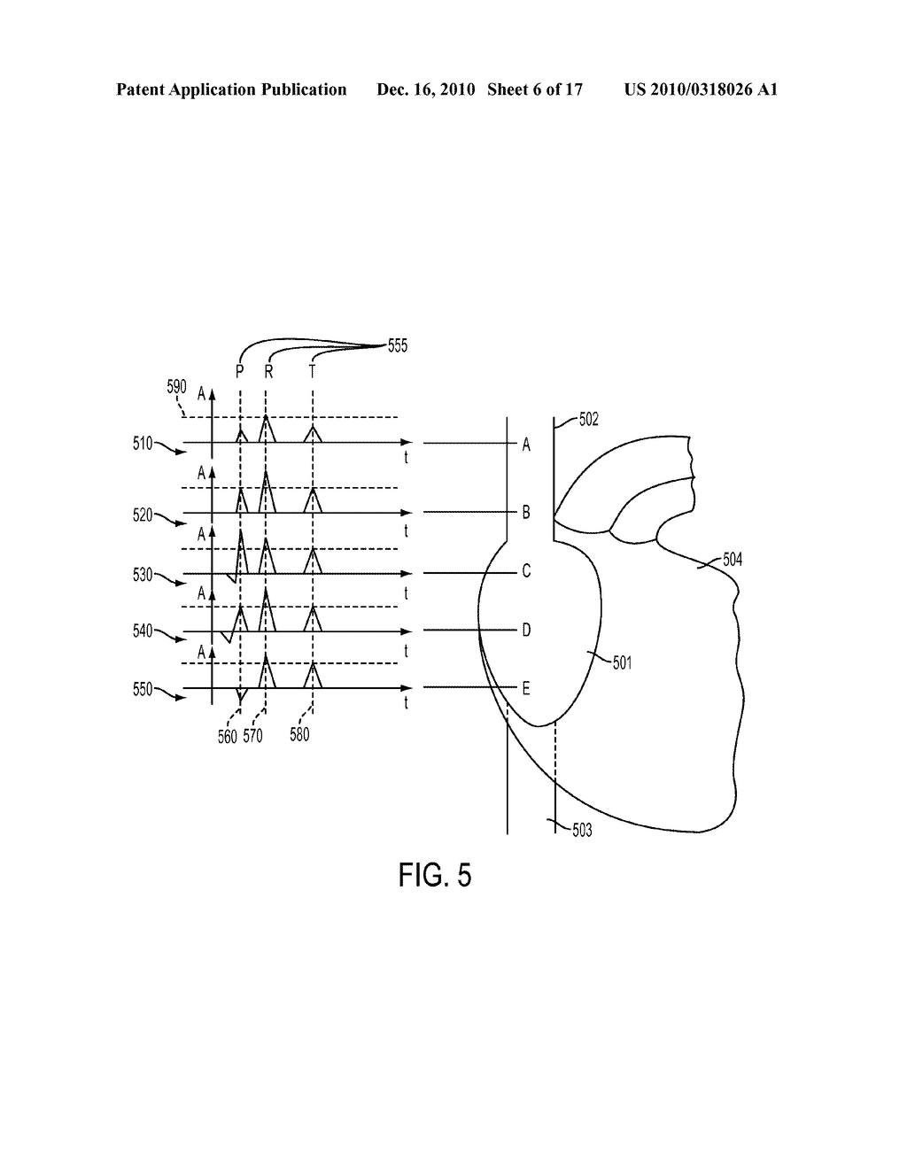 Devices and Methods for Endovascular Electrography - diagram, schematic, and image 07