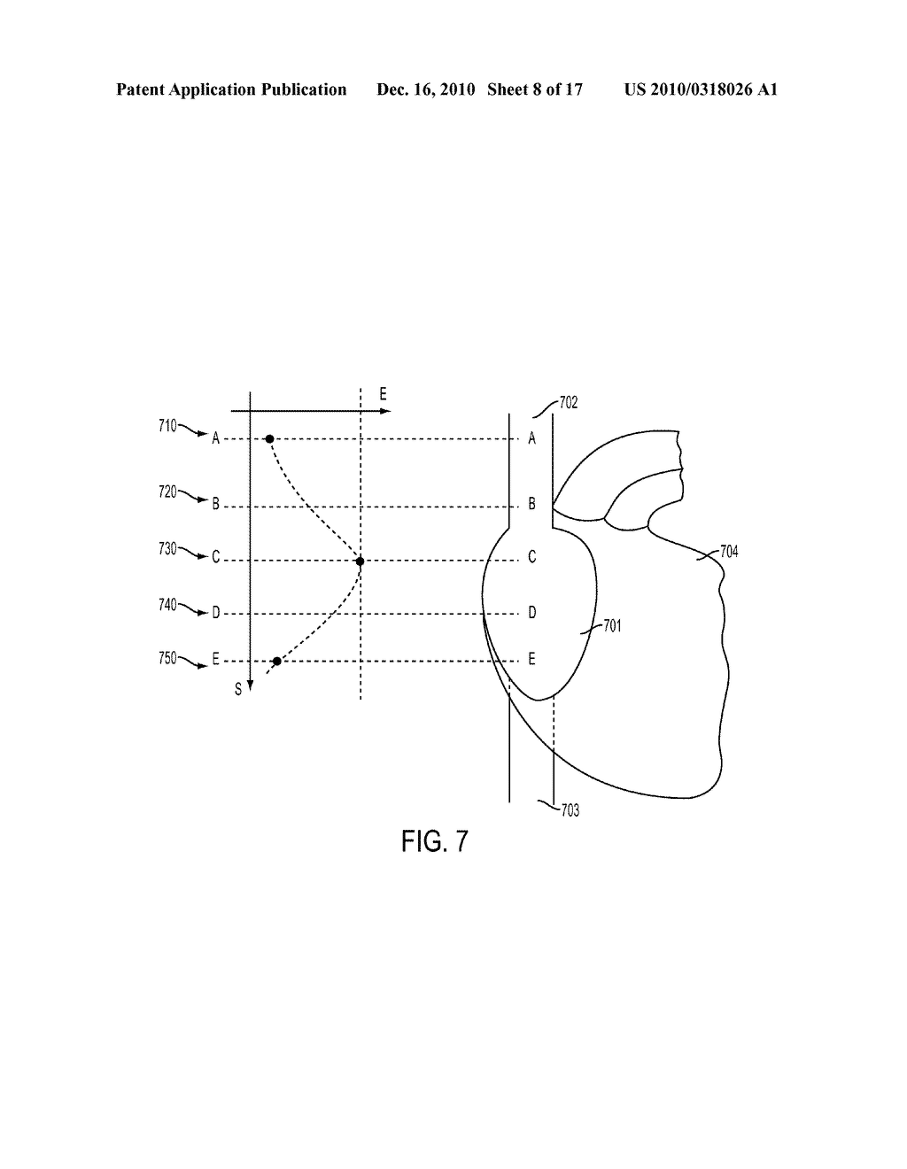 Devices and Methods for Endovascular Electrography - diagram, schematic, and image 09