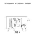 Devices and Methods for Endovascular Electrography diagram and image