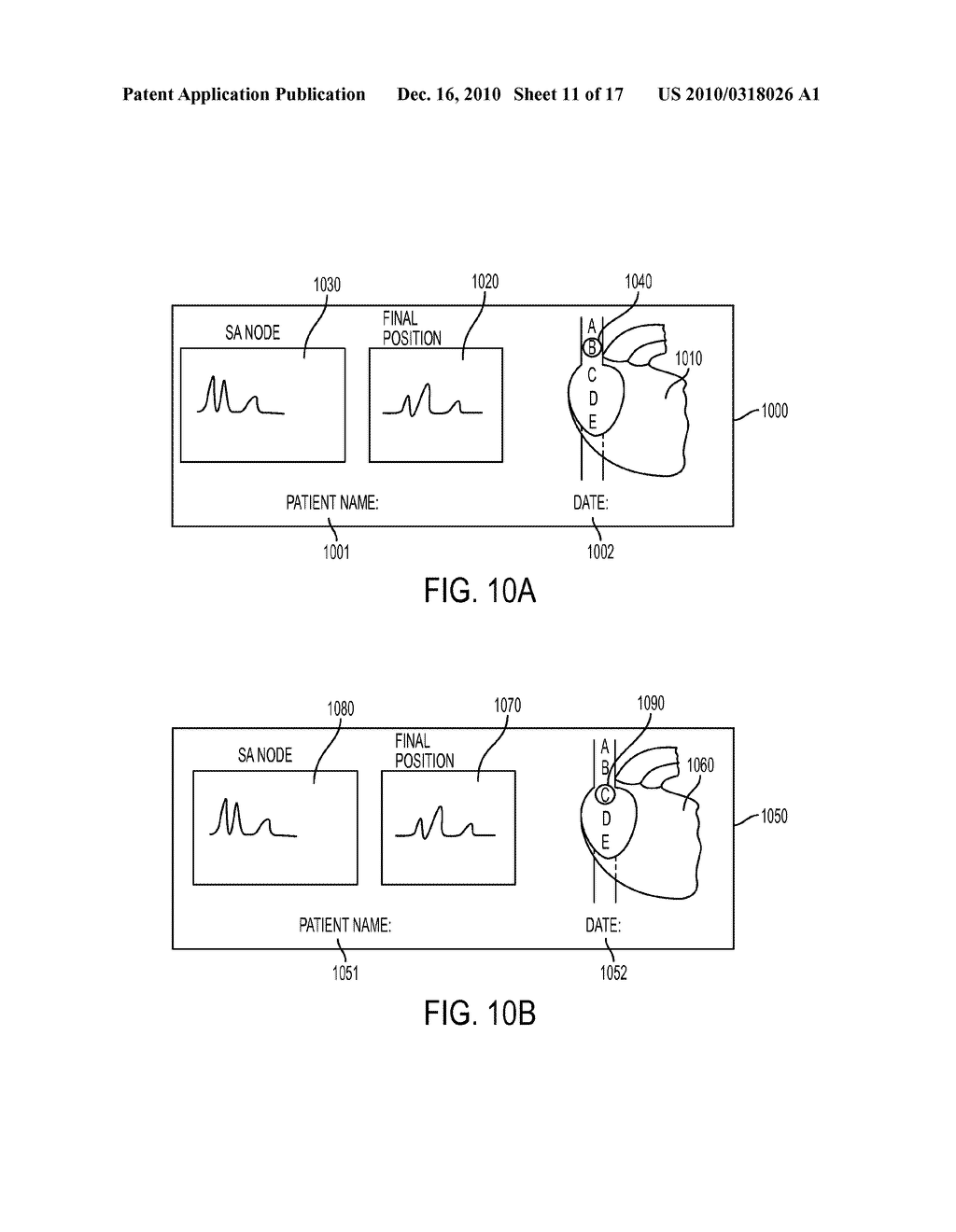 Devices and Methods for Endovascular Electrography - diagram, schematic, and image 12