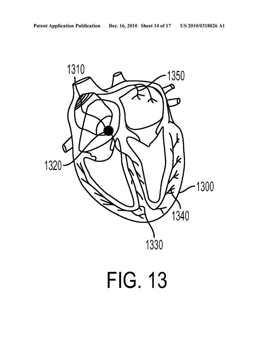 Devices and Methods for Endovascular Electrography - diagram, schematic, and image 15