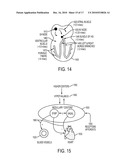 Devices and Methods for Endovascular Electrography diagram and image