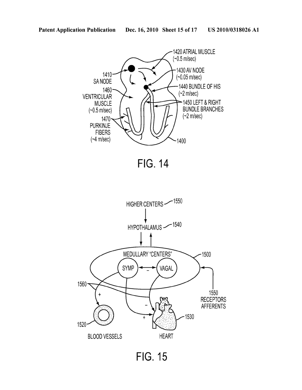 Devices and Methods for Endovascular Electrography - diagram, schematic, and image 16