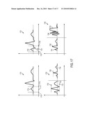 Devices and Methods for Endovascular Electrography diagram and image