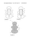 COMBINATION PAD AND PANTY SHIELD WITH RAISED CHANNEL diagram and image