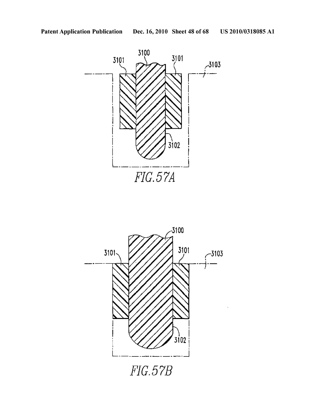 INTERNAL FIXATION DEVICES - diagram, schematic, and image 49