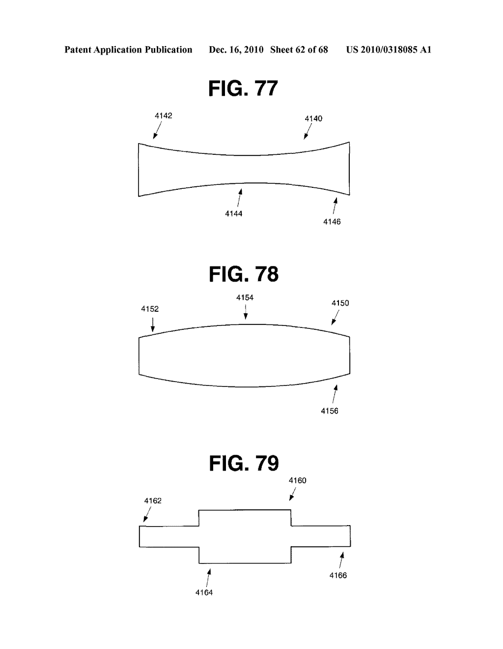 INTERNAL FIXATION DEVICES - diagram, schematic, and image 63