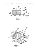 SYSTEMS AND METHODS FOR FORMING A CAVITY IN CANCELLOUS BONE diagram and image