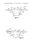 SYSTEMS AND METHODS FOR FORMING A CAVITY IN CANCELLOUS BONE diagram and image