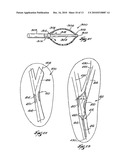 SYSTEMS AND METHODS FOR FORMING A CAVITY IN CANCELLOUS BONE diagram and image