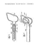 SYSTEMS AND METHODS FOR FORMING A CAVITY IN CANCELLOUS BONE diagram and image