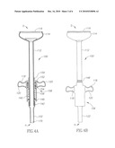 Obstetrical vacuum extractor with over-traction release diagram and image