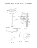 Obstetrical vacuum extractor with over-traction release diagram and image