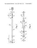 Systems and Methods for Implanting Medical Devices diagram and image