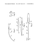 Systems and Methods for Implanting Medical Devices diagram and image