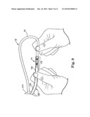 Systems and Methods for Implanting Medical Devices diagram and image