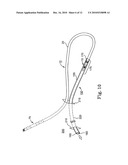 Systems and Methods for Implanting Medical Devices diagram and image